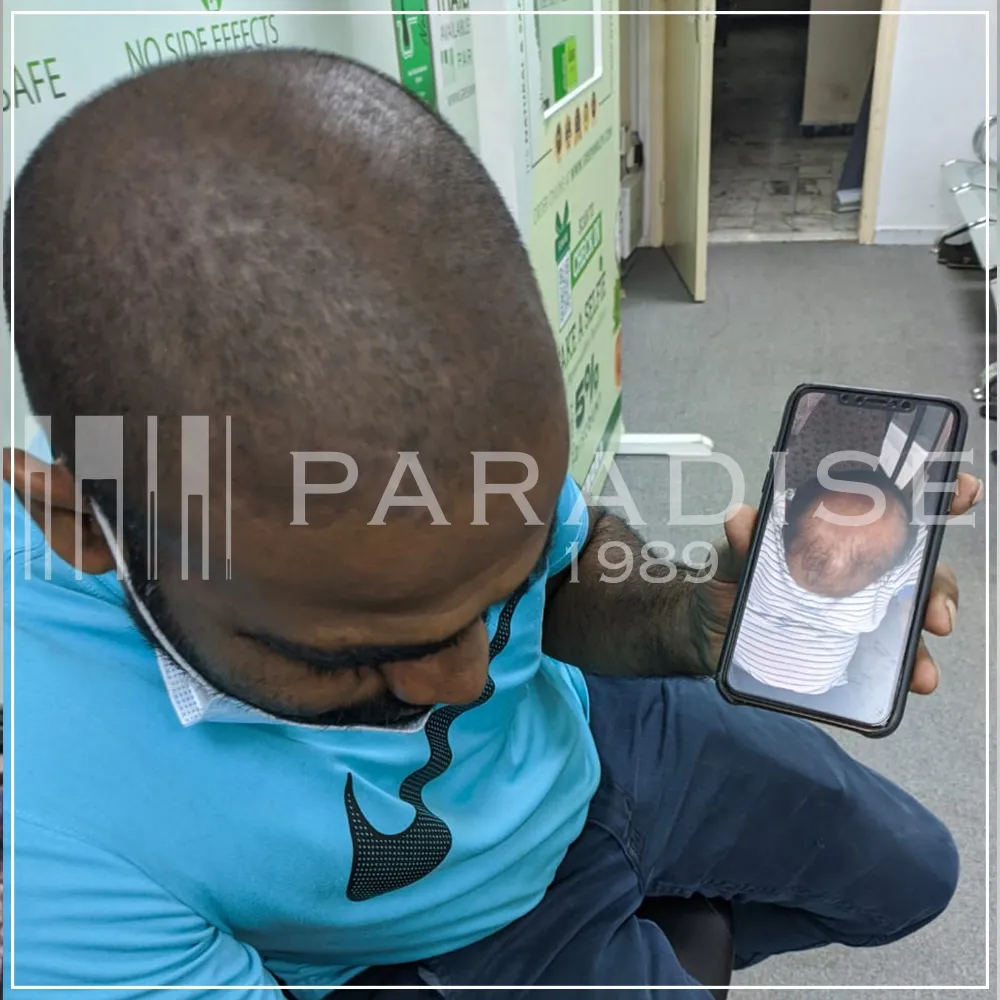 Verified customer photo review by Ahmed K. for Green Wealth Neo Hair products