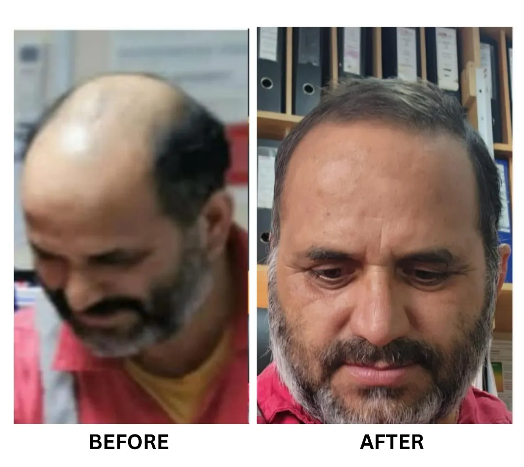 A customer's hair before and after (3)