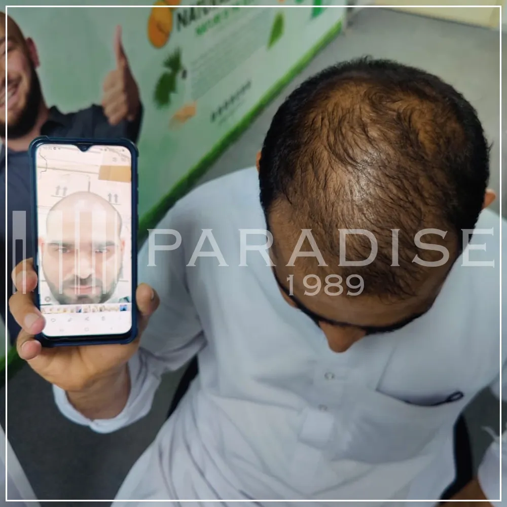Verified customer photo review by Arun K. for Green Wealth Neo Hair products