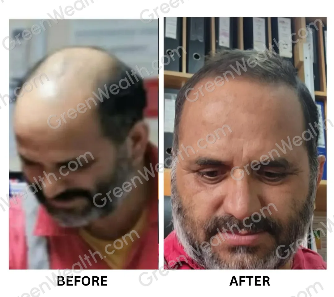 A customer's hair before and after (3)