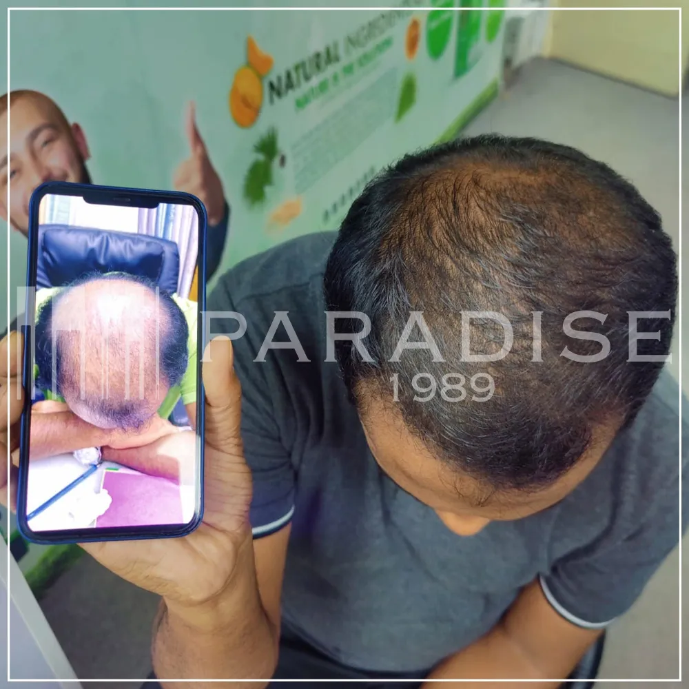 Verified customer photo review by Hassan B. for Green Wealth Neo Hair products