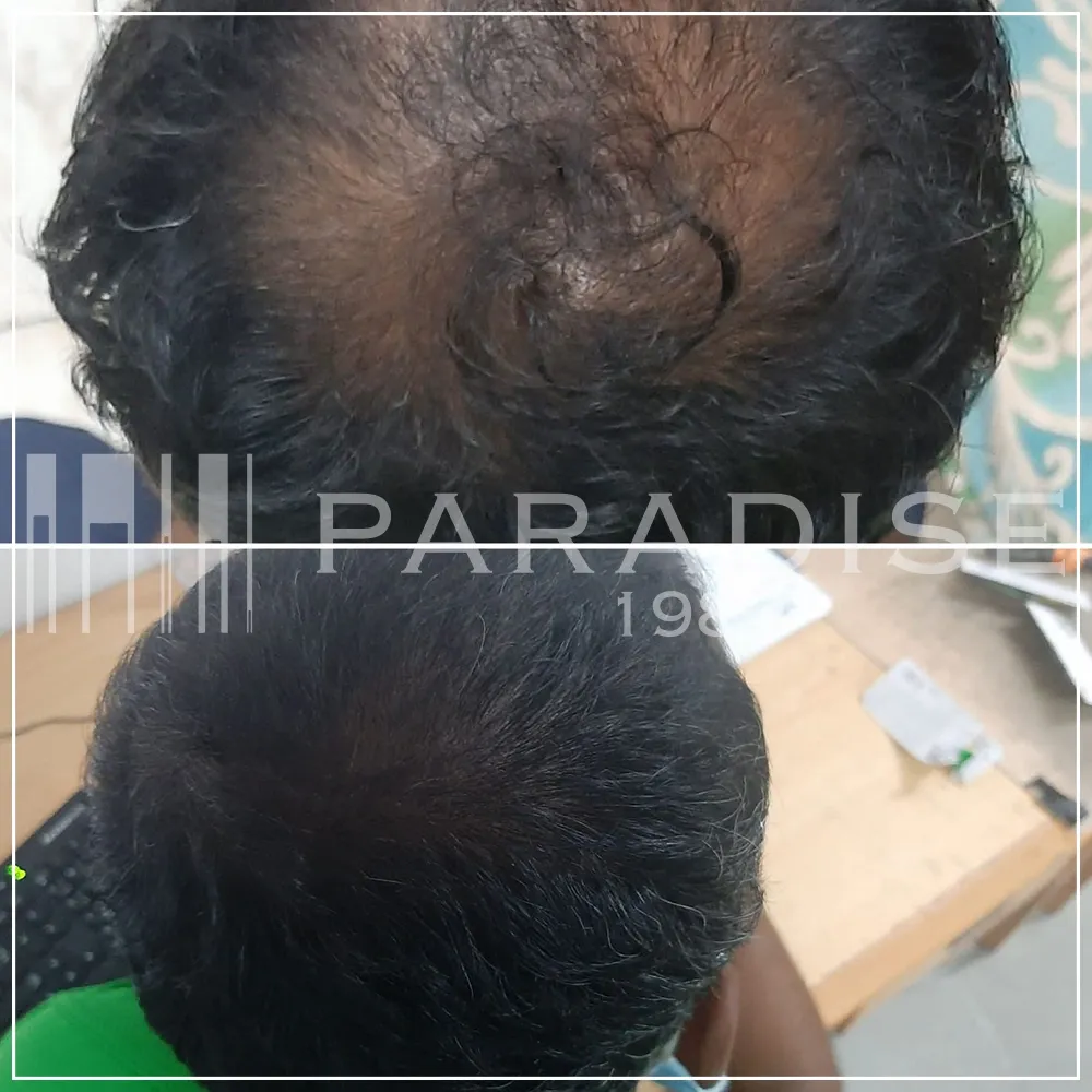 Verified customer photo review by Omar H. for Green Wealth Neo Hair products