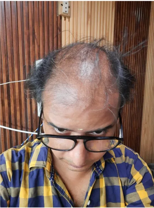 A customer's hair before and after (1): Before