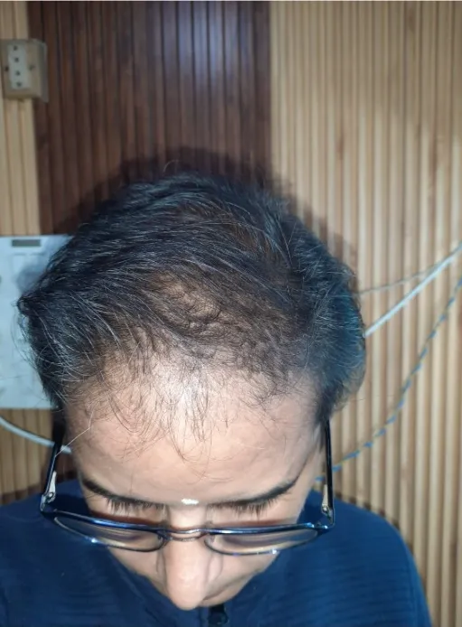 A customer's hair before and after (1): After