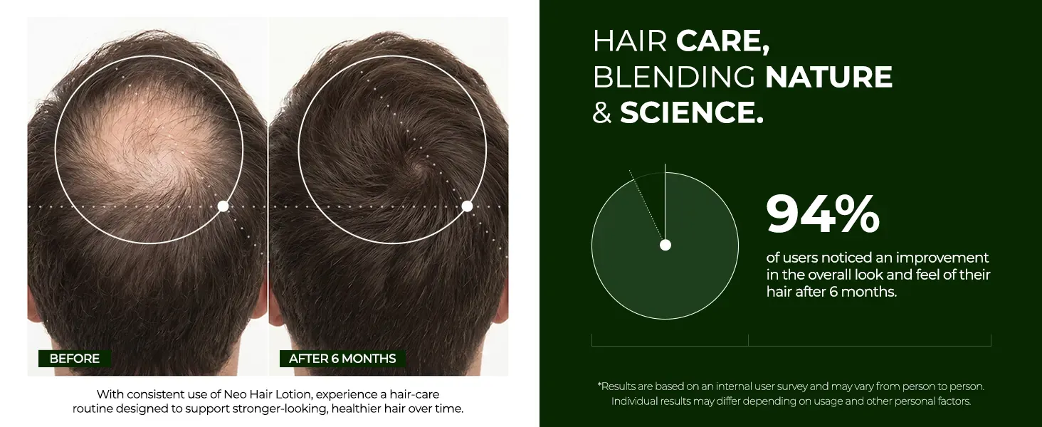 Neo Hair Lotion banner comparing the botanical formula with pharmaceutical alternatives