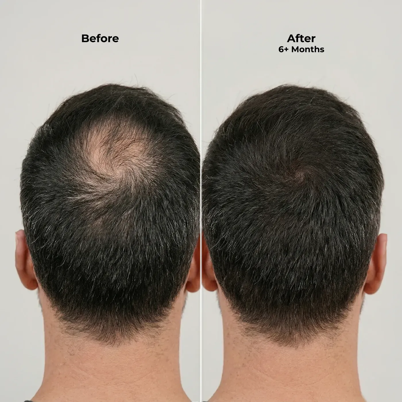Ghori® Derma Roller — Good to know Ghori® Derma Roller — Good to know